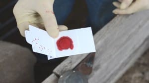 A small blood sample is all that is required to undertake a Sheep Genomics Selection Test.