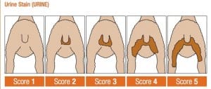 Urine-stain-score